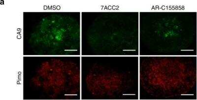 Representative immunofluorescent pictures of CA9 and pimonidazole stainings in FaDu spheroids treated with 20uM 7ACC2 or AR-C155858 for 5 days. Scale bars: 100um. Image collected and cropped by CiteAb from the following publication (), licensed under a CC-BY license. Image collected and cropped by CiteAb from the following publication (nature.com/articles/s41467-018-03525-0), licensed under a CC-BY license.